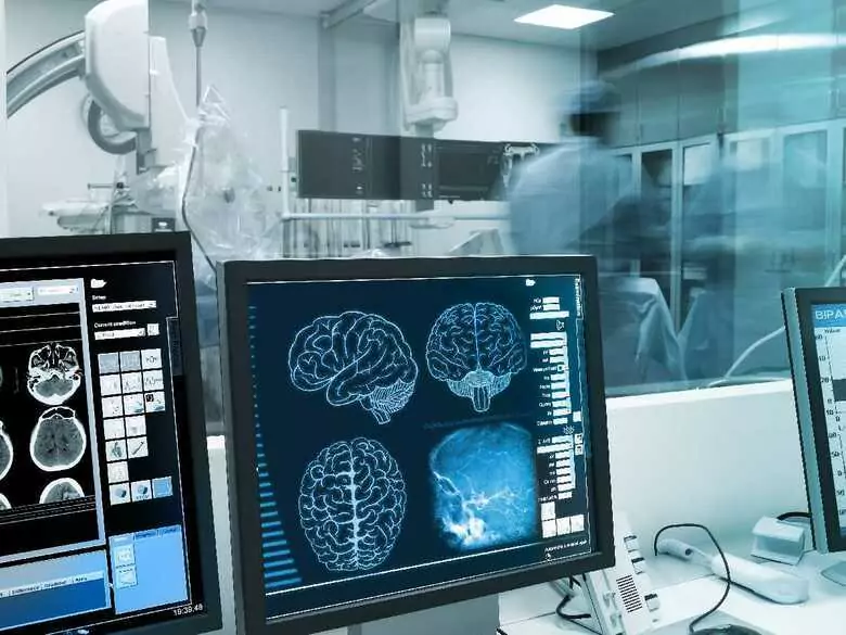 Adénome hypophysaire - causes, symptômes, diagnostic, traitement