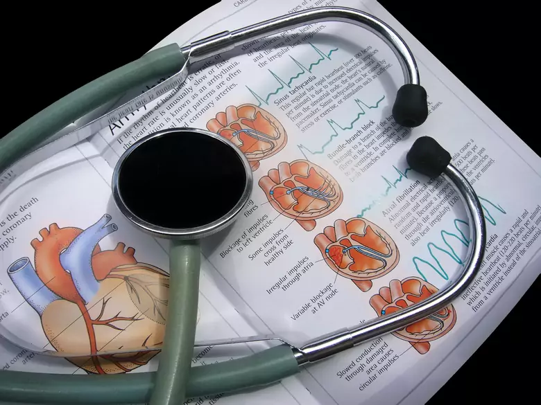 Endocardite infectieuse