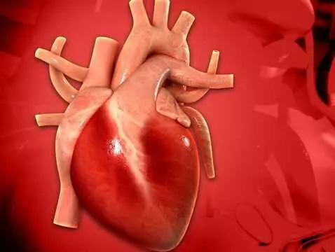 Syndrome de prolapsus des feuillets de la valve bicuspide - causes, symptômes, diagnostic, traitement