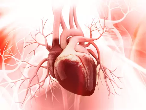 Cardiopathie ischémique - causes, symptômes, diagnostic, traitement