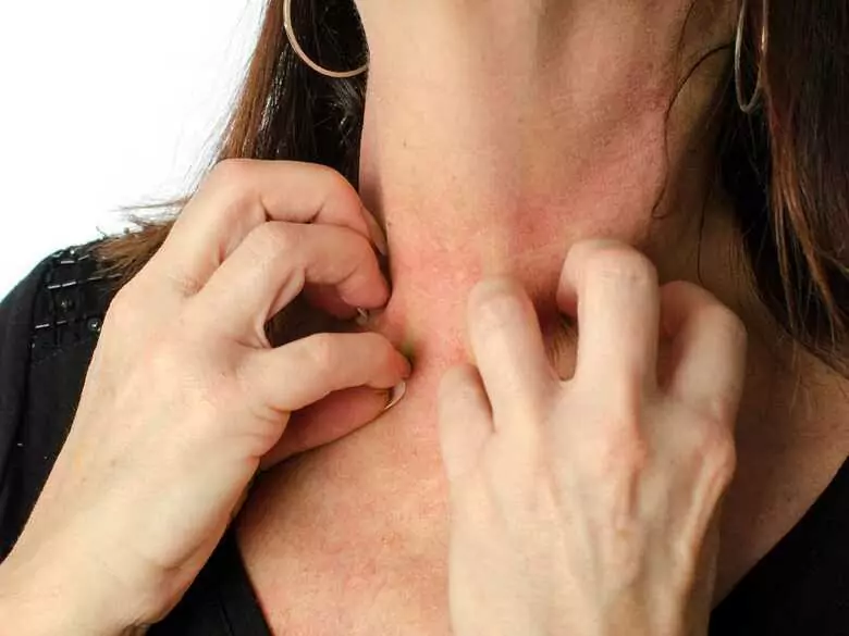 Pourquoi la peau démange-t-elle ?