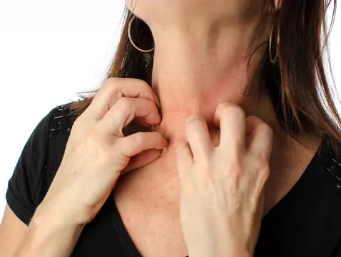 Pourquoi la peau démange-t-elle ?