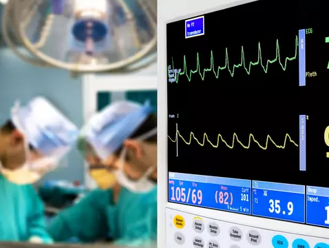 Implantation d'un stimulateur cardiaque