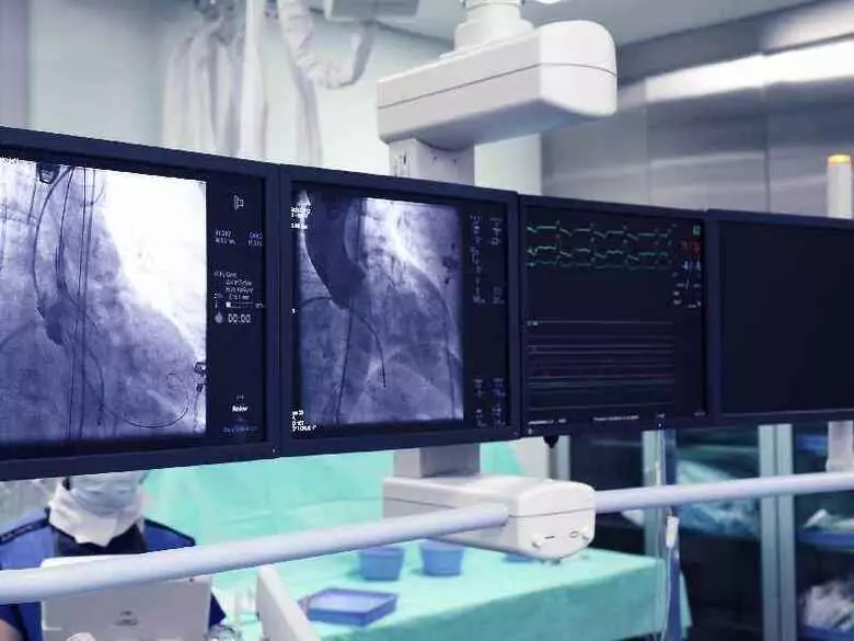 Quels sont les avantages de la revascularisation coronarienne ?