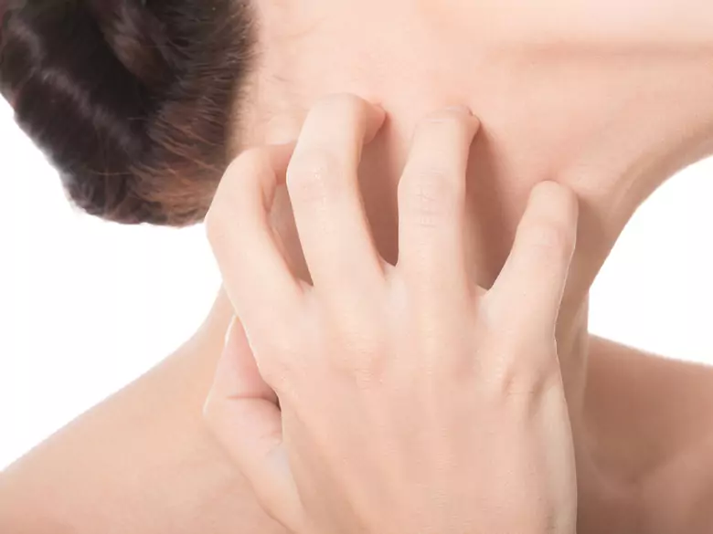 Dermatite atopique : comment la traiter ?