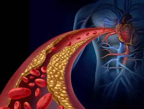 Artérite tubéreuse - causes, symptômes, diagnostic, traitement