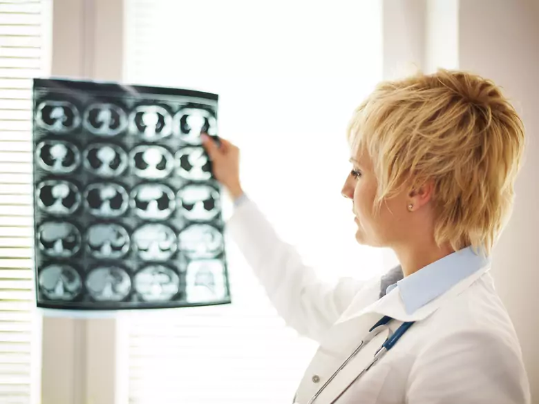 AIT - accidents ischémiques transitoires