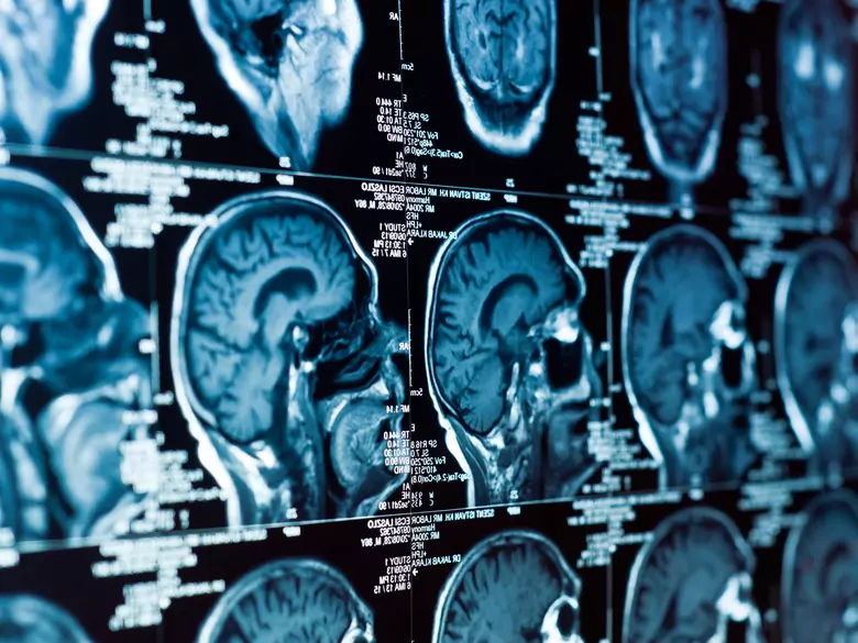 Diagnostic oncologique