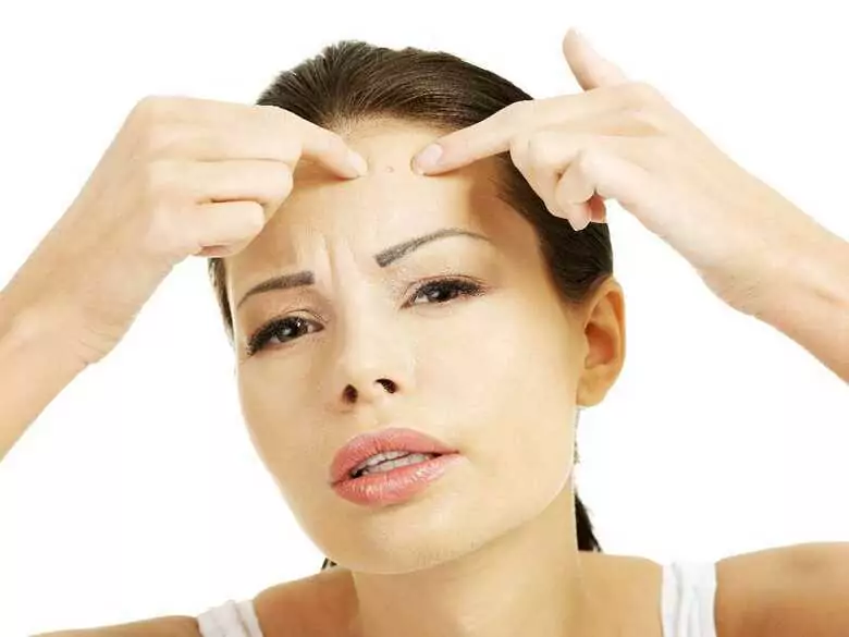 Acné après 30 ans : que faut-il savoir ?