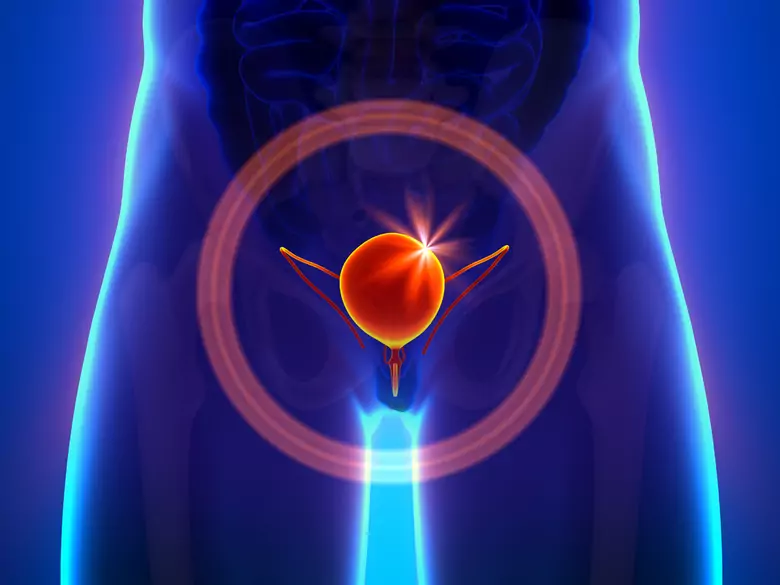 Qu'est-ce qu'un régime alimentaire sain pour les personnes souffrant de troubles urinaires ?