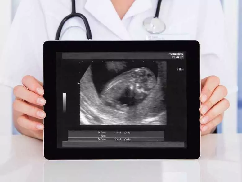 Grossesse extra-utérine - qu'est-ce que c'est et quelles sont ses causes ?