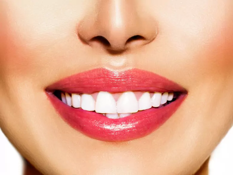 Appareil dentaire interne