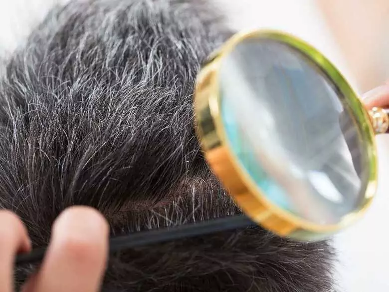 Les poux chez les enfants - comment les traiter et les prévenir efficacement ?