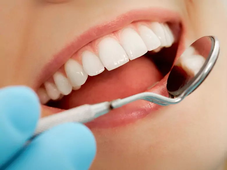 Taches blanches sur les dents - d'où viennent-elles ?