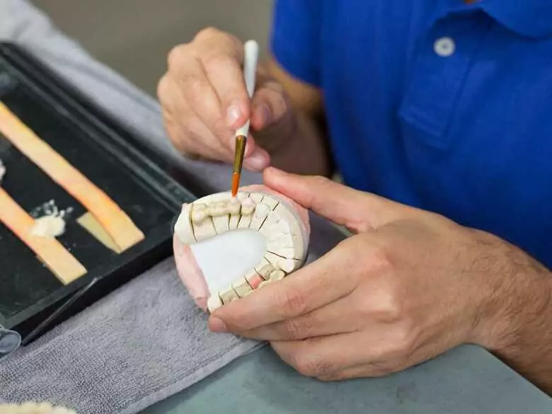 Dentelle ou facette - que choisir ?