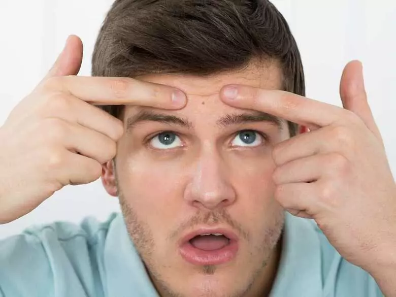 Emollients pour l'acné de l'adulte